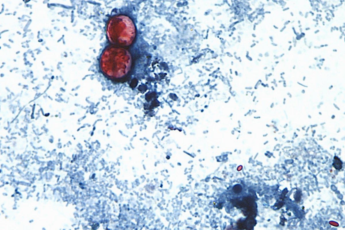 UK holidaymakers warned as cyclospora outbreak linked to Mexico travel