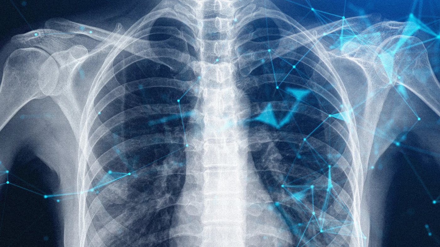 AI Is Reshaping Three Medical Specialties, Shifting Doctors Toward Treatment Strategy